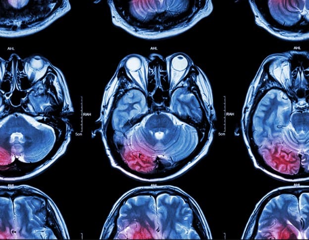Powered brain scan analysis for medical diagnostics.